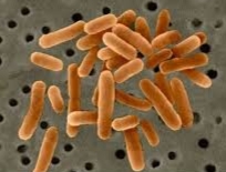 legionella 1.jpg